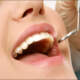 Dental Exam