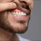 Gum Disease